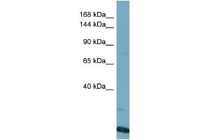 Host:  Rabbit  Target Name:  VPS8  Sample Type:  HT1080 Whole Cell lysates  Antibody Dilution:  1. (VPS8 抗体  (N-Term))