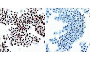 Immunohistochemical staining of SV40 large T, small t antigen. (SV40 Large T and Small Ts 抗体 (Biotin))