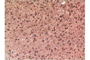 Immunohistochemical analysis of paraffin-embedded Rat Brain Tissue using Tau Mouse mAb diluted at 1:200. (tau 抗体)