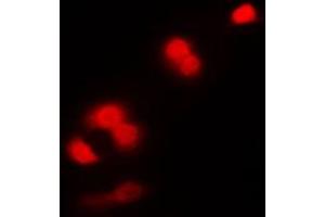 Immunofluorescent analysis of CDC2 staining in K562 cells. (CDK1 抗体  (Center))