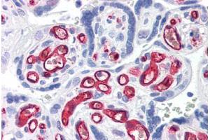 Human Placenta (formalin-fixed, paraffin-embedded) stained with CD34 antibody ABIN337371 at 10 ug/ml followed by biotinylated anti-mouse IgG secondary antibody ABIN481714, alkaline phosphatase-streptavidin and chromogen. (CD34 抗体)