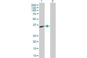 Western Blot analysis of MS4A1 expression in transfected 293T cell line by MS4A1 MaxPab polyclonal antibody. (CD20 抗体  (AA 1-297))