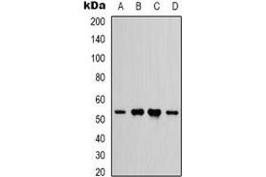 Western blot analysis of IFNGR1 expression in HEK293T (A), Hela (B), rat heart (C), rat brain (D) whole cell lysates. (IFNGR1 抗体)