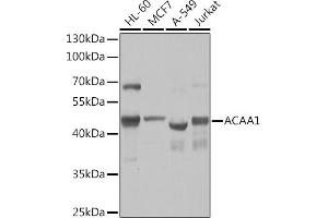 Western blot analysis of extracts of various cell lines, using  Rabbit pAb  at 1:1000 dilution. (ACAA1 抗体  (AA 27-300))