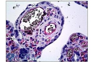 Immunohistochemistry (IHC) image for anti-Endothelium antibody (ABIN1107095) (Endothelium 抗体)