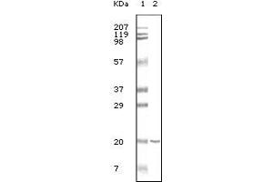 Western blot analysis using CD19 mouse mAb against CD19 recombinant protein. (CD19 抗体)