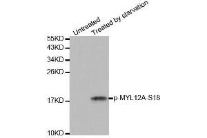 Western blot analysis of extracts from 293 cells untreated or treated with starvation using Phospho-MYL12A-S18 antibody (ABIN2988196). (MYL12A 抗体  (pSer18))