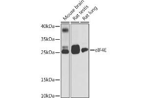 Western blot analysis of extracts of various cell lines, using eIF4E antibody (ABIN6134340, ABIN6140083, ABIN6140085 and ABIN6221700) at 1:1000 dilution. (EIF4E 抗体  (AA 1-100))