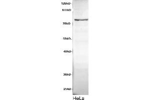 Western Blotting (WB) image for anti-Cadherin 8 (CDH8) antibody (ABIN5958176) (Cadherin 8 抗体)