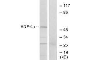 Western blot analysis of extracts from HT-29 cells, using HNF4 alpha (Ab-313) Antibody. (HNF4A 抗体  (AA 280-329))
