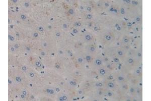 IHC-P analysis of Human Liver Tissue, with DAB staining. (CXCL12 抗体)