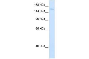 DHX9 antibody used at 0. (DHX9 抗体)