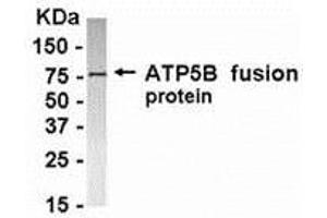 Western Blotting (WB) image for anti-ATP Synthase, H+ Transporting, Mitochondrial F1 Complex, beta Polypeptide (ATP5B) (AA 291-539) antibody (ABIN2468164) (ATP5B 抗体  (AA 291-539))