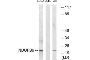 Western Blotting (WB) image for anti-NADH Dehydrogenase (Ubiquinone) 1 beta Subcomplex, 9, 22kDa (NDUFB9) (Internal Region) antibody (ABIN1851644) (NDUFB9 抗体  (Internal Region))