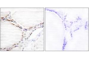 Immunohistochemistry analysis of paraffin-embedded human thyroid gland tissue, using Vitamin D Receptor (Ab-208) Antibody. (Vitamin D Receptor 抗体  (AA 181-230))