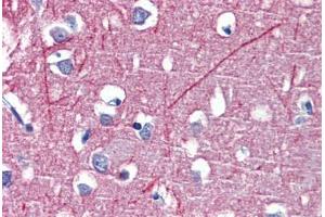 Brain, cortex, Human: Formalin-Fixed, Paraffin-Embedded (FFPE) (PSMB5 抗体)