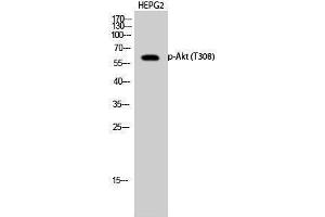 Western Blotting (WB) image for anti-V-Akt Murine Thymoma Viral Oncogene Homolog 1 (AKT1) (pThr308) antibody (ABIN3182380) (AKT1 抗体  (pThr308))