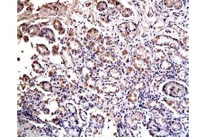 Immunohistochemistry (Paraffin-embedded Sections) (IHC (p)) image for anti-SRY (Sex Determining Region Y)-Box 2 (SOX2) (AA 227-317) antibody (ABIN669621)