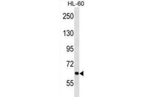 Western Blotting (WB) image for anti-Ankyrin Repeat and KH Domain Containing 1 (ANKHD1) antibody (ABIN2998597) (ANKHD1 抗体)