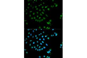 Immunofluorescence analysis of MCF-7 cells using XRCC2 antibody (ABIN5970910). (XRCC2 抗体)