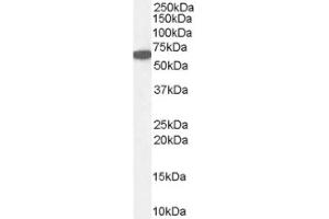 Image no. 1 for anti-Catalase (CAT) (Internal Region) antibody (ABIN374696) (Catalase 抗体  (Internal Region))