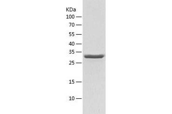 HMGCR Protein (AA 588-887) (His tag)