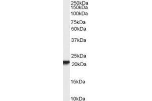 ABIN2564911 (0. (RBP4 抗体  (Internal Region))
