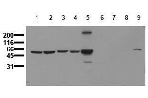 Western Blotting (WB) image for anti-Vimentin (VIM) antibody (ABIN126914) (Vimentin 抗体)
