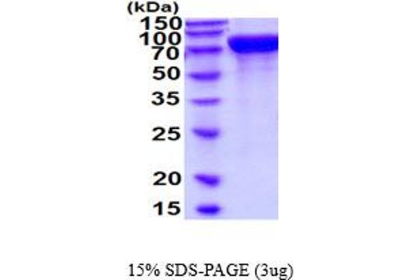 Meprin B Protein (AA 21-654) (His tag)