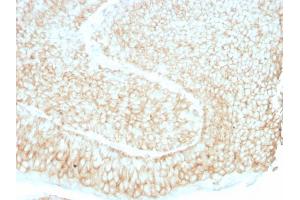 Formalin-fixed, paraffin-embedded human bladder stained with CD59 Mouse Monoclonal Antibody (193-27). (CD59 抗体)