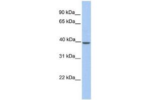 KLK-BL4 antibody used at 1 ug/ml to detect target protein. (KLK-BL4 (C-Term) 抗体)