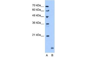 Crystallin Alpha B antibody used at 5 ug/ml to detect target protein. (CRYAB 抗体  (C-Term))