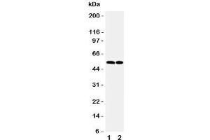 Western blot testing of CCR3 antibody and Lane 1:  K562;  2: Raji cell lysate. (CCR3 抗体  (N-Term))