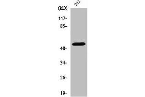 Western Blot analysis of 293 cells using Cleaved-MMP-14 (Y112) Polyclonal Antibody (MMP14 抗体  (Cleaved-Tyr112))