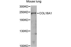 Western blot analysis of extracts of mouse lung, using COL18A1 antibody (ABIN5970861) at 1/1000 dilution. (COL18A1 抗体)
