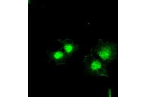 Anti-BCL2L1 mouse monoclonal antibody (ABIN2452380) immunofluorescent staining of COS7 cells transiently transfected by pCMV6-ENTRY BCL2L1 (RC201314). (BCL2L1 抗体  (AA 1-212))