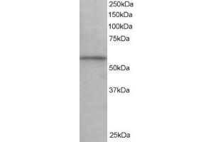 Western Blotting (WB) image for anti-Karyopherin alpha 3 (Importin alpha 4) (KPNA3) antibody (ABIN5921579) (KPNA3 抗体)