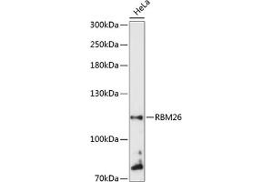 Western blot analysis of extracts of HeLa cells, using RBM26 antibody  at 1:3000 dilution. (RBM26 抗体  (AA 65-140))