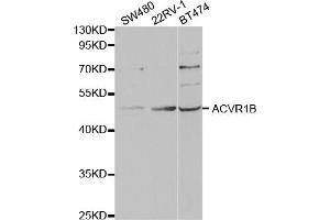 Western blot analysis of extracts of various cell lines, using ACVR1B antibody. (Activin A Receptor Type IB/ALK-4 抗体)