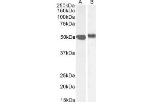 Western Blotting (WB) image for anti-Forkhead Box A1 (FOXA1) (C-Term) antibody (ABIN185021)