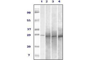 Western Blotting (WB) image for anti-RAB25, Member RAS Oncogene Family (RAB25) antibody (ABIN1844336) (RAB25 抗体)
