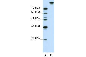 WB Suggested Anti-SF3B1 Antibody Titration:  0. (SF3B1 抗体  (N-Term))