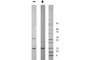 SDS-PAGE of Human globular ACRP-30 Recombinant Protein SDS-PAGE of Human globular ACRP-30 Recombinant Protein. (ADIPOQ 蛋白)