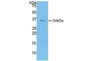 Detection of Recombinant IRF4, Mouse using Polyclonal Antibody to Interferon Regulatory Factor 4 (IRF4) (IRF4 抗体  (AA 175-433))