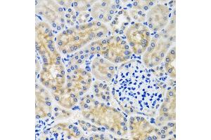 Immunohistochemistry of paraffin-embedded mouse kidney using ANTXR2 antibody at dilution of 1:100 (x40 lens). (ANTXR2 抗体)