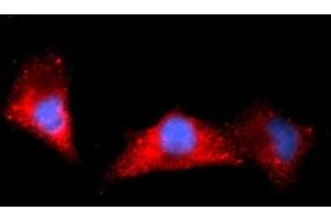 Immunofluorescence (IF) image for anti-Aldehyde Dehydrogenase 1 Family, Member A1 (ALDH1A1) (AA 1-501) antibody (APC) (ABIN5568626) (ALDH1A1 抗体  (AA 1-501) (APC))