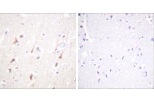 Peptide - +Immunohistochemistry analysis of paraffin-embedded human brain tissue using IRS-1 antibody. (IRS1 抗体)