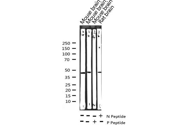 CEBPA 抗体  (pSer21)