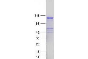 EXD3 Protein (Myc-DYKDDDDK Tag)