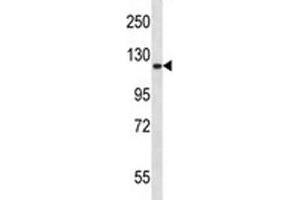 Epha2 antibody western blot analysis in mouse lung tissue lysate. (EPH Receptor A2 抗体  (AA 296-323))